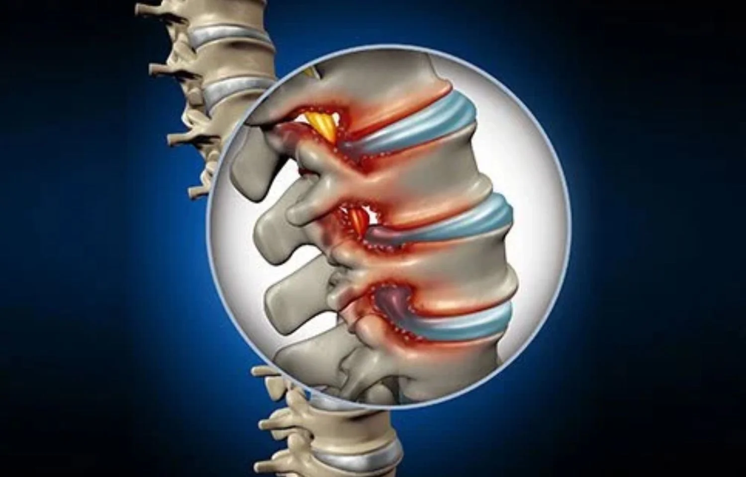 A zoomed-in circular view of a spinal cord design.