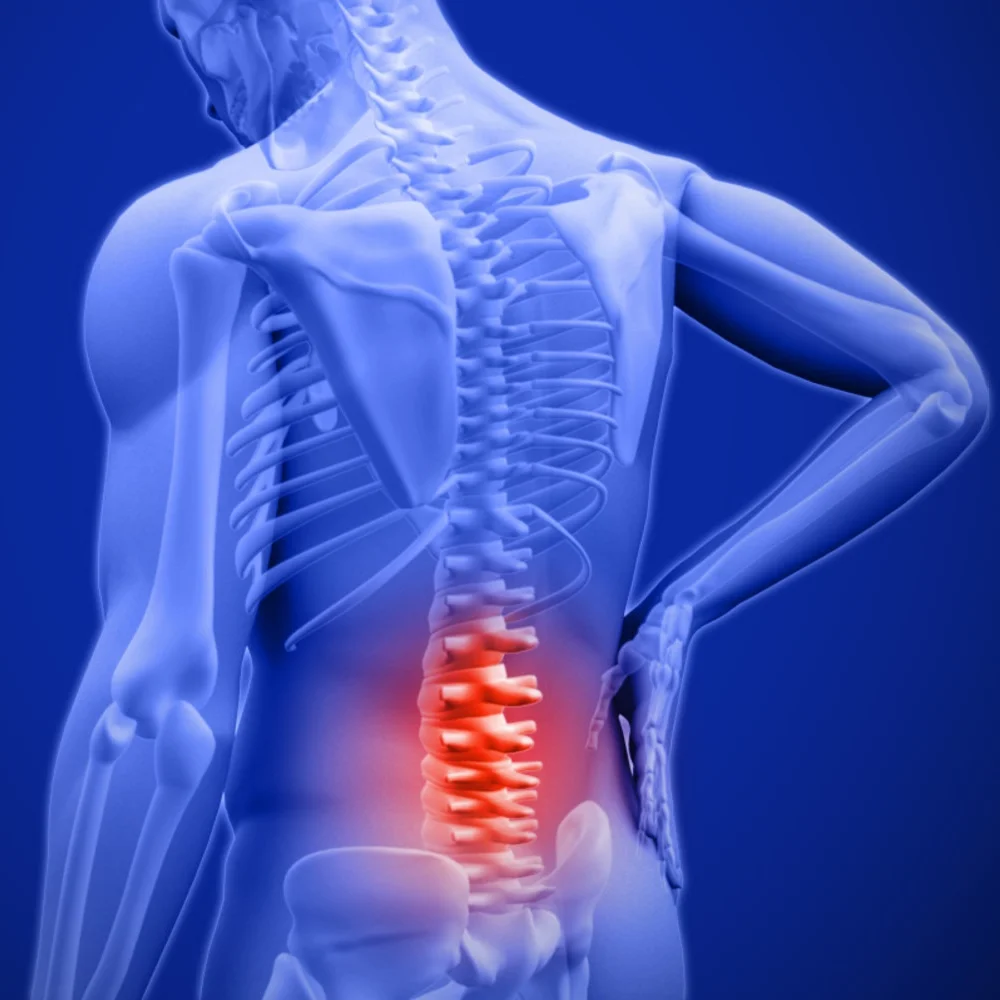 A stylized illustration of a person suffering from lower back pain.