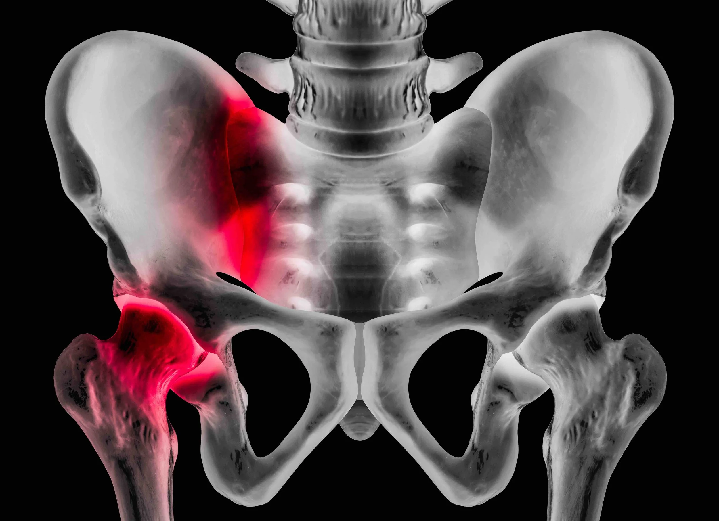 Sacroiliac Joint