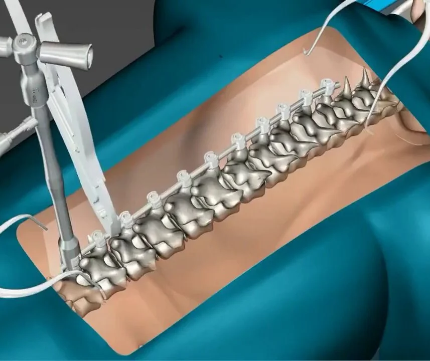 A 3D model of the human spine viewed from the back.