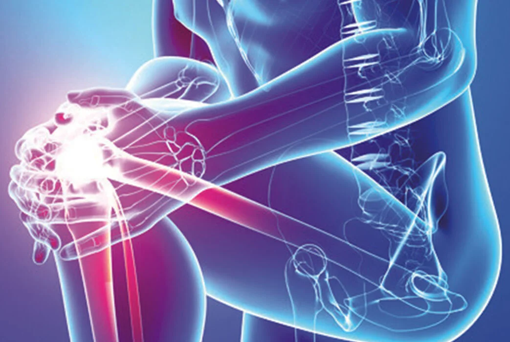 A 3D model of a knee joint showing inflammation and pain in the joint.